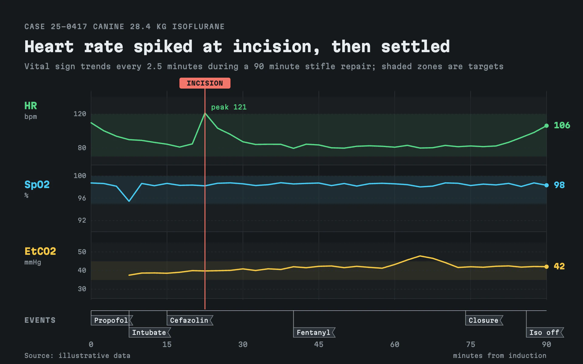 Anesthesia Record line chart, dark theme: Monitor-style vital sign lanes in monospace with event flags on a bottom rail.