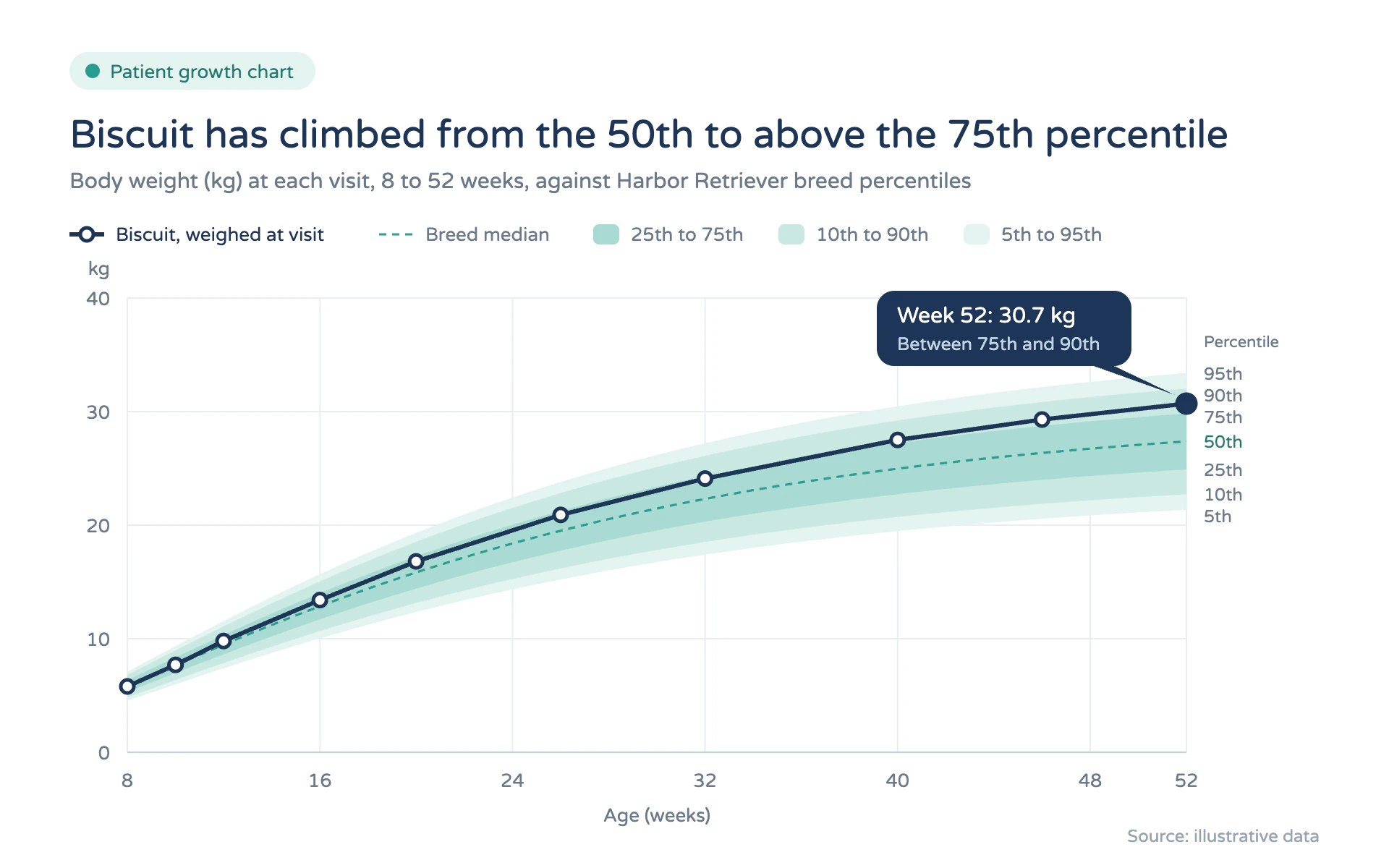 Growth Percentiles line chart, light theme: Clinic growth chart with soft teal percentile bands and one navy patient line.