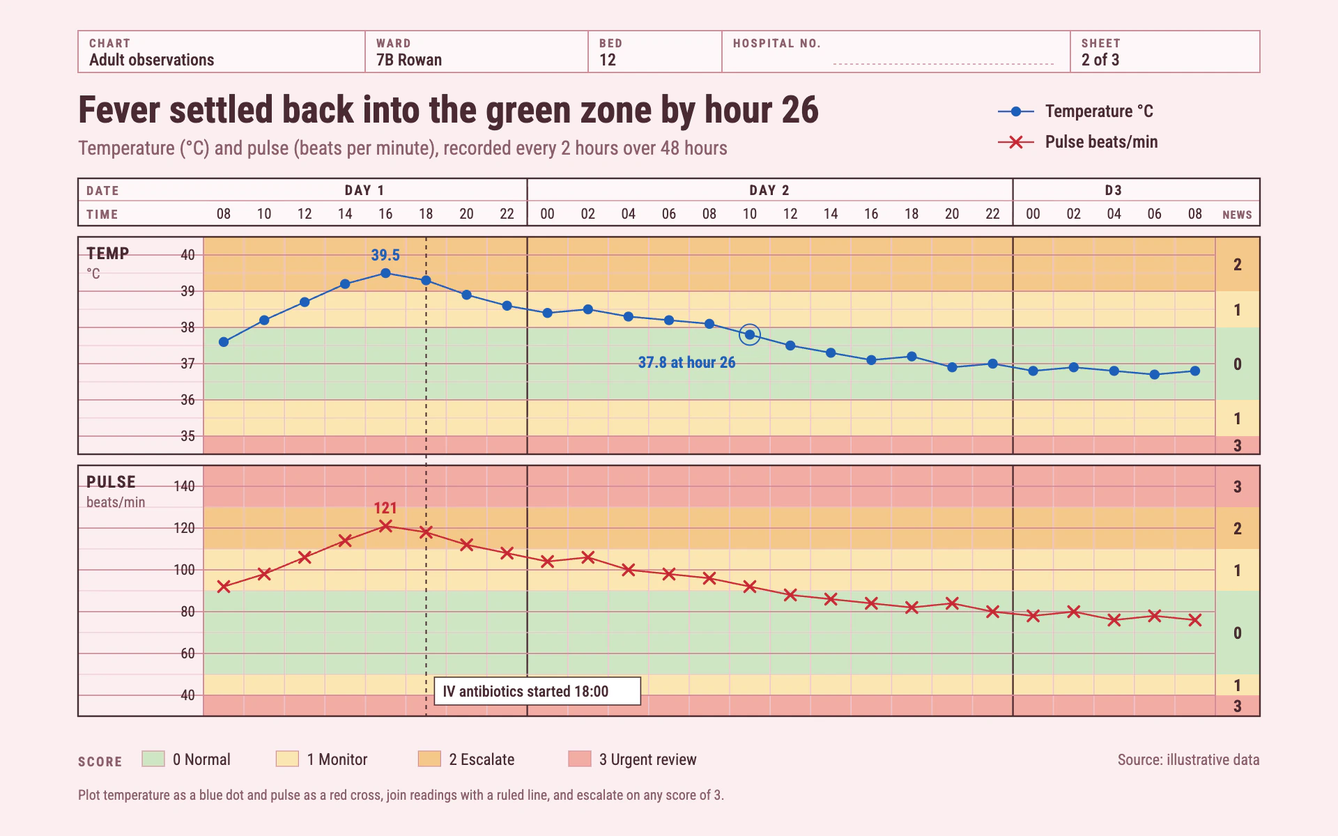 Obs Chart line chart, light theme: A pink hospital observation sheet with scoring zones, blue dots and red crosses.