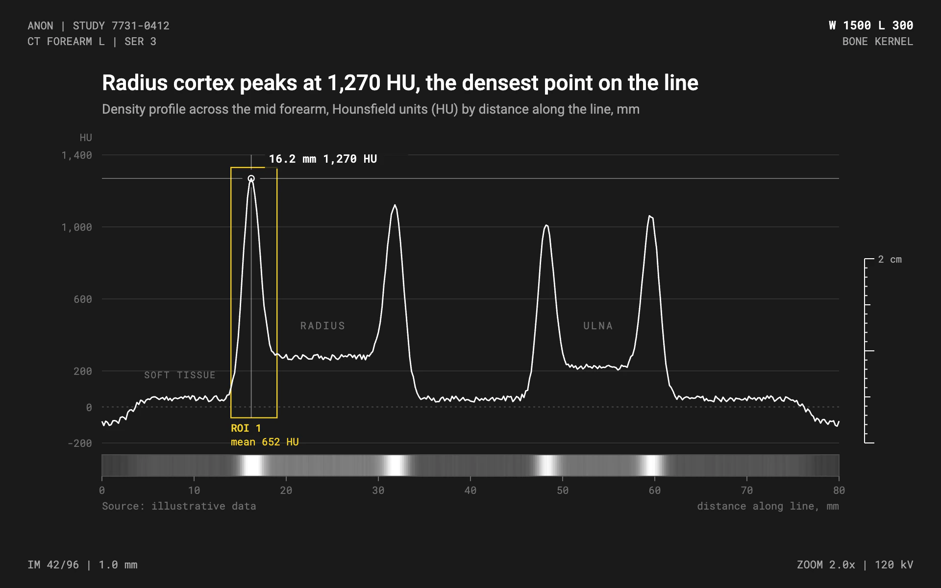 Radiology Viewer line chart, dark theme: An imaging workstation profile with a grayscale strip, ROI box and corner overlays.