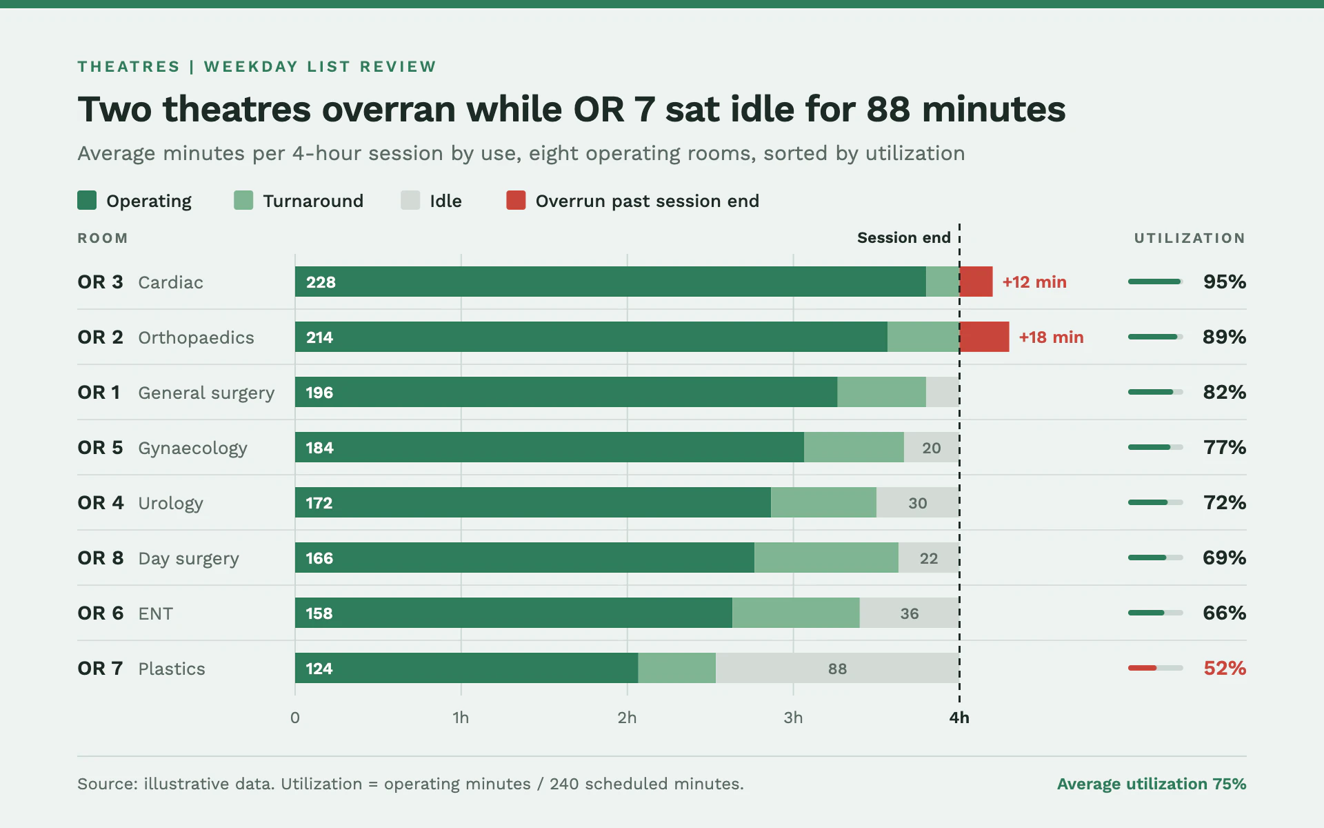 Theatre Utilization bar chart, light theme: Surgical green session bars split into operating, turnaround, idle and red overrun.